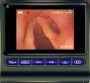 Video endoscop flexibil portabil MBC5